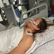 Woman's Cold Symptoms Led to Leg Amputation After Flesh-Eating Disease