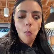 Woman's eye bulges when she eats due to rare condition, but she loves it