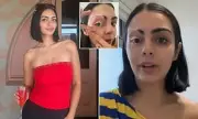 Woman's Tropical Holiday Leads to Vitiligo Diagnosis After 5.6M-View Video