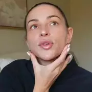 Zara McDermott dissolves jaw filler after revealing heartbreaking beauty standard insecurities