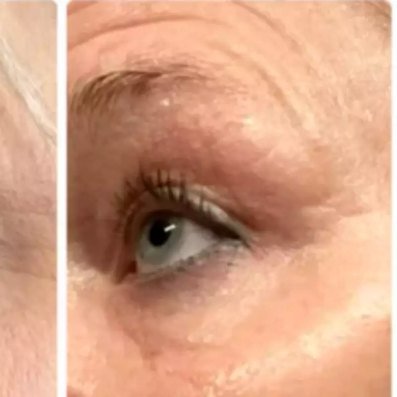 Alien-Like Anti-Wrinkle Gadget Now 20% Off: Red Light Therapy Mask Boasts 96% Success