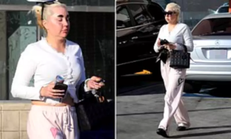 Amanda Bynes Flaunts Slimmed Figure in LA After Ozempic Weight Loss Journey