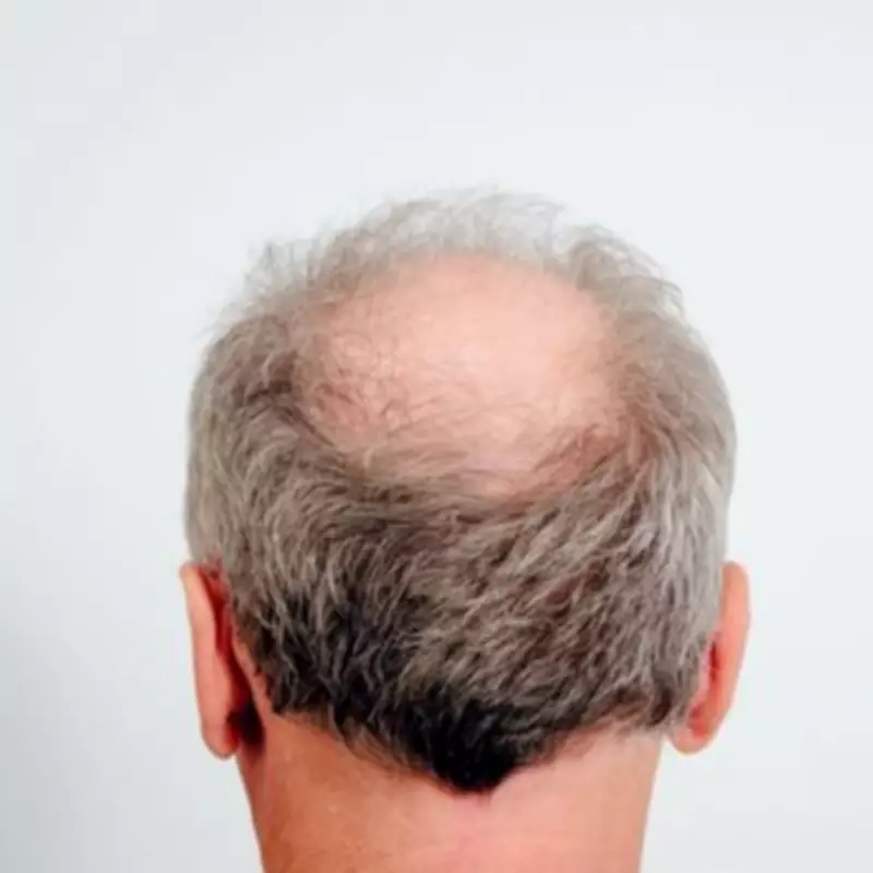 Ancient Chinese Herb He Shou Wu Offers Multi-Target Hope for Hair Loss Treatment