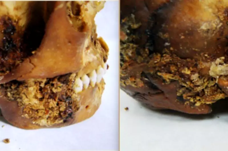 Ancient Siberian Mummy Reveals Pioneering Jaw Surgery 2,500 Years Ago
