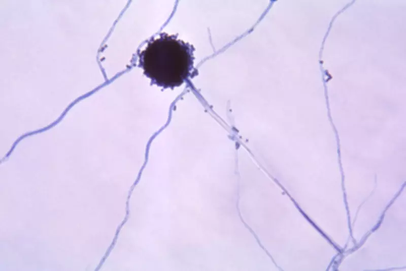 Aspergillus Mould Outbreak at Sydney Hospital Claims Two Lives