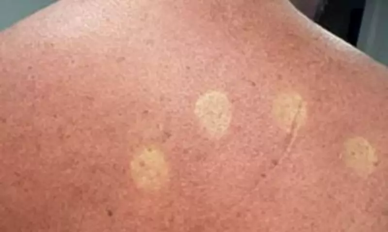 Australia Post Scraps New Uniform After Workers Report Sunburn