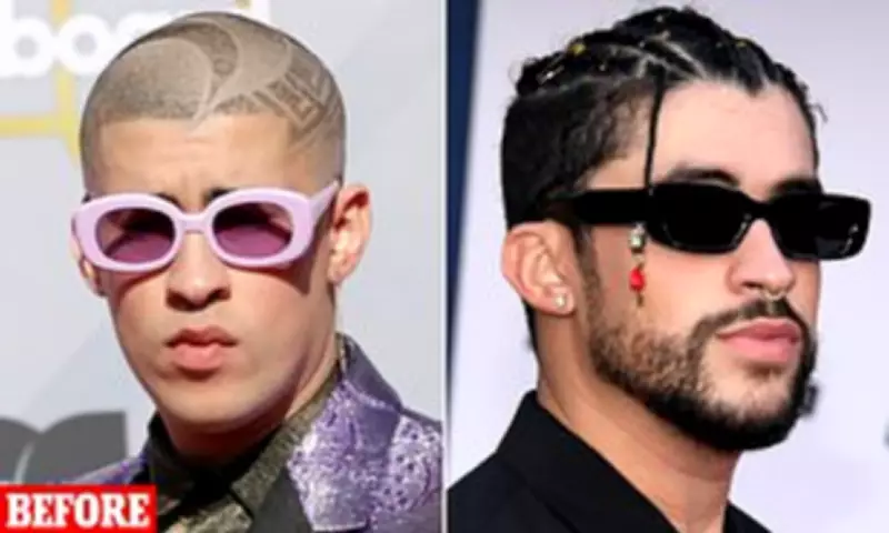 Bad Bunny's Dramatic Transformation: Experts Suggest Cosmetic Enhancements