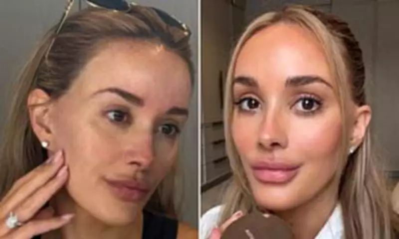 Bec Judd Details Extensive Cosmetic Journey and Filler Complications