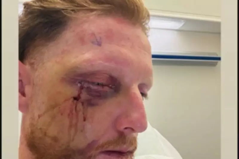 Ben Stokes Recovers from Surgery After Cricket Ball Facial Injury