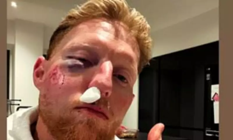 Ben Stokes Shares Shocking Injury Photo Amid Recovery and Future Plans