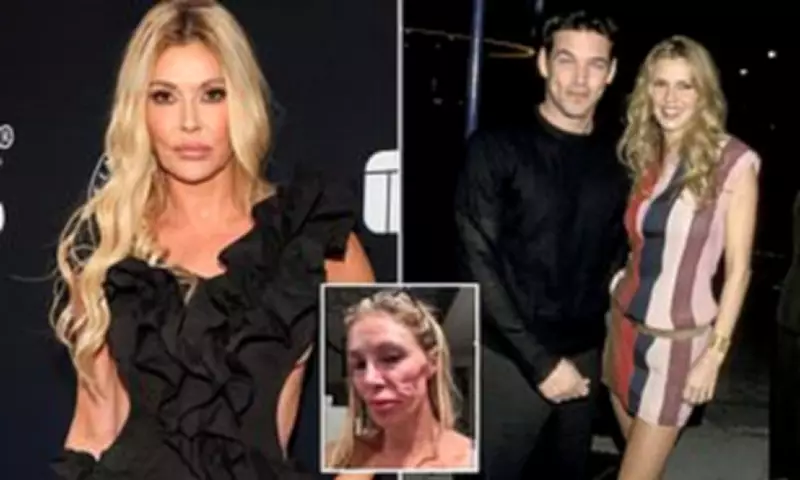 Brandi Glanville Reveals Ex-Husband's Lack of Support During $200K Health Crisis