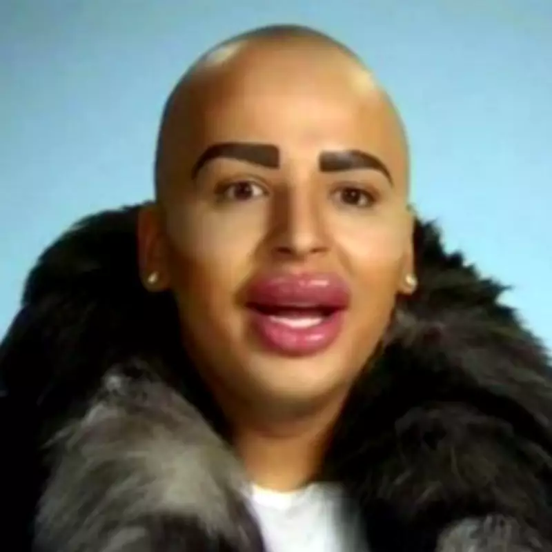 Britain's 'Lip King' Jordan James Parke Dies, Family Heartbroken