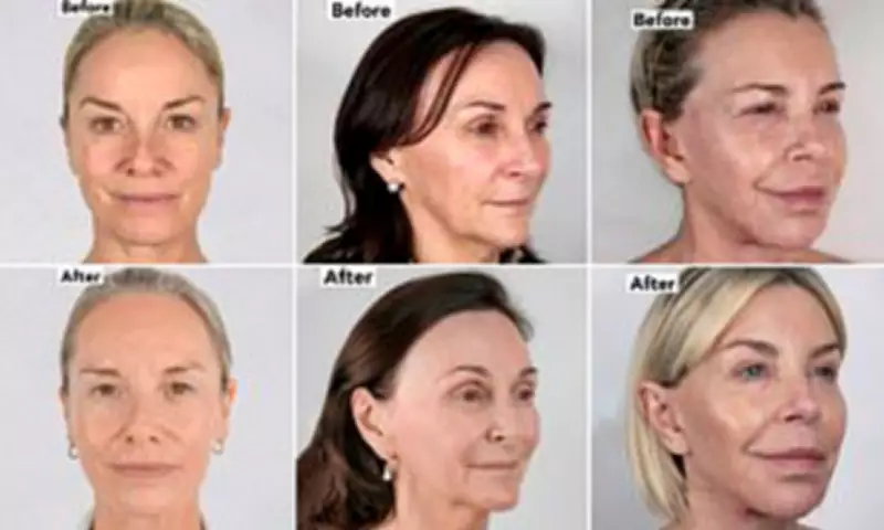 Celebrities Reveal Secret to Youthful Look with Non-Surgical Facelift