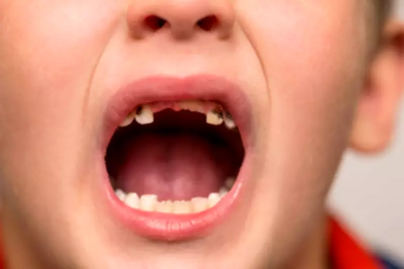 Children's Dental Crisis Deepens as Hospital Tooth Extractions Surge 14%