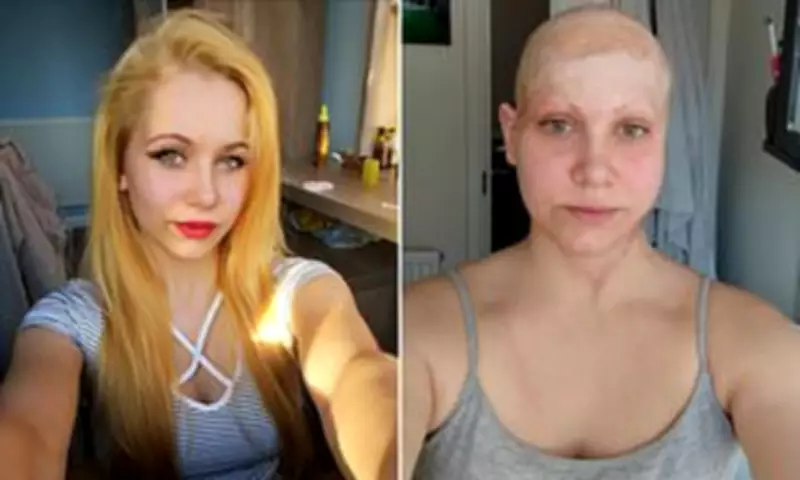 Coventry Mother's Scalp Torn Off in Factory Drill Horror: Children Now Struggle to Recognise Her