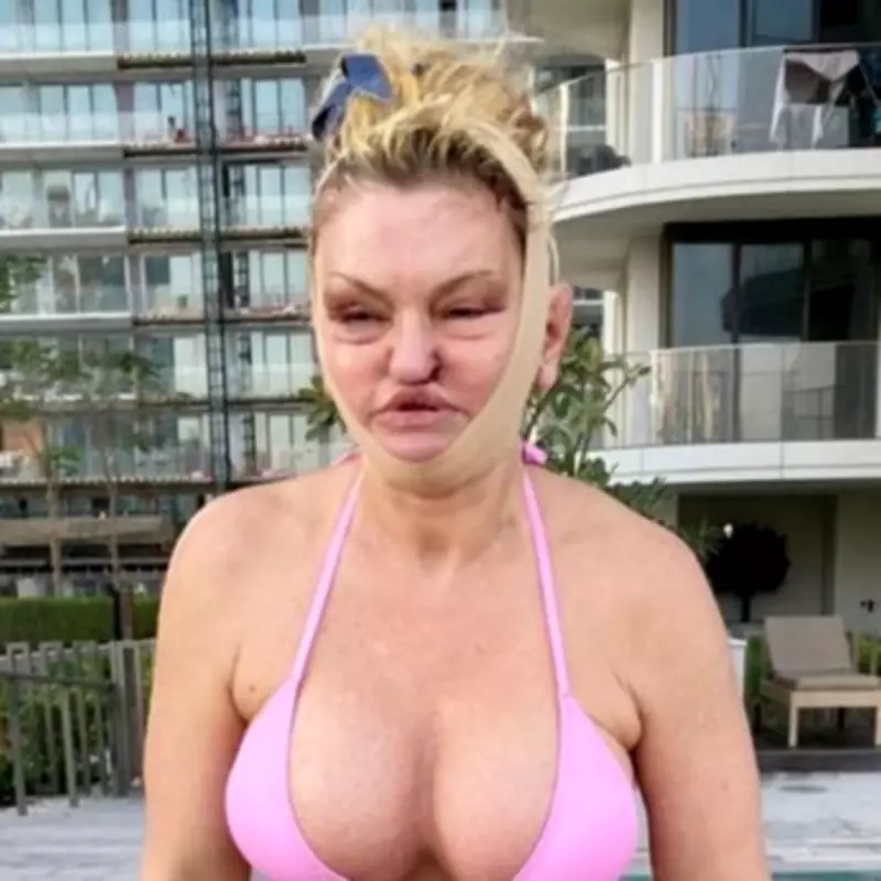 Danniella Westbrook Recuperates in Dubai After Extensive Facial Reconstruction Surgery