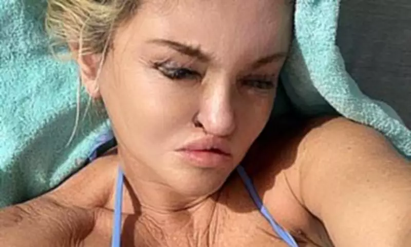 Danniella Westbrook Reveals New Face After Major Reconstructive Surgery in Dubai