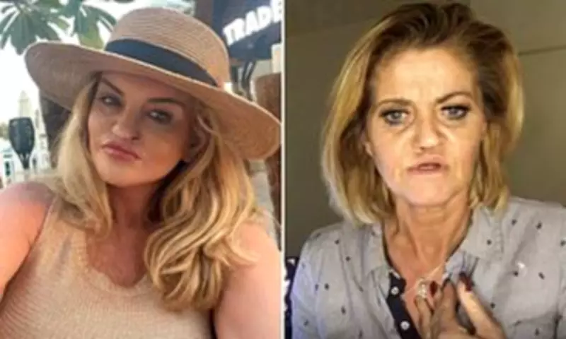 Danniella Westbrook Reveals Three More Nose Surgeries After Major Facial Reconstruction