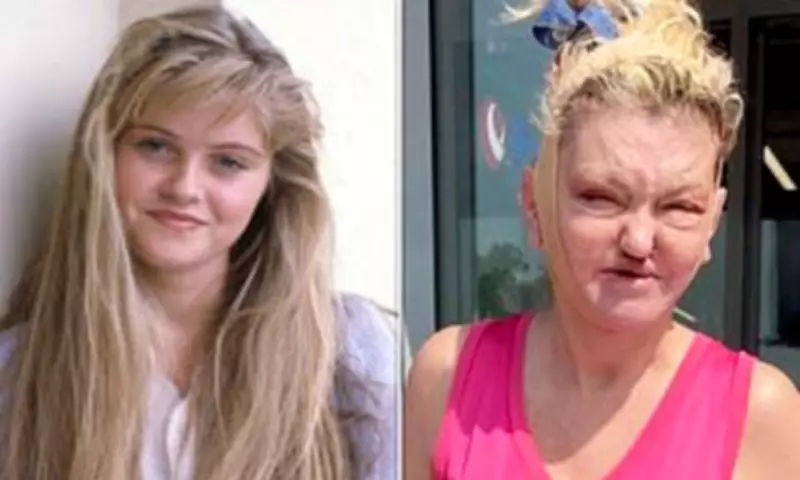 Danniella Westbrook's Facial Reconstruction Journey After Addiction Damage