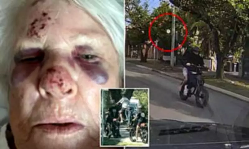 E-Bike Menace Escalates in Sydney's Northern Beaches as Elderly Victim Hospitalised