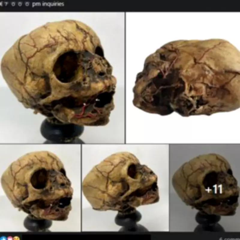 Exclusive: Ministers Urged to Ban Sale of Human Remains as Child's Skull Sold Online