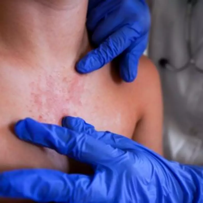 Four Victorian-Era Diseases Are Making a Concerning Comeback in Modern Britain