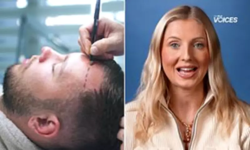 Inside the Baldness Boom: How Social Media Made Turkey a Hair Transplant Hub