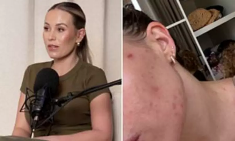 Kate Ferdinand Reveals Dubai Relocation Causing Severe Skin Breakouts and Boils