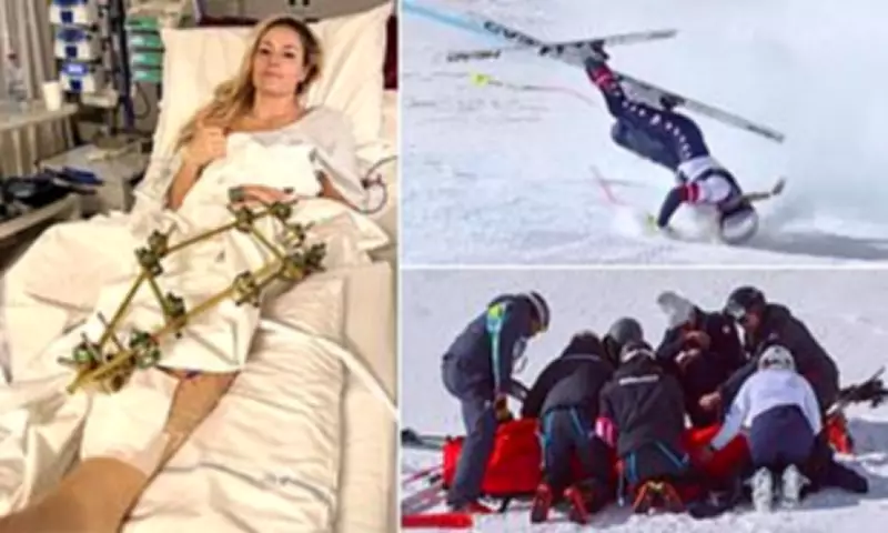 Lindsey Vonn Faces Amputation Risk After Olympic Crash, Surgeon Warns