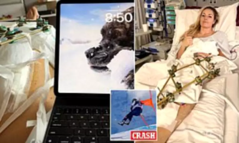 Lindsey Vonn Faces Fifth Surgery After Olympic Crash, Mourns Beloved Dog Leo