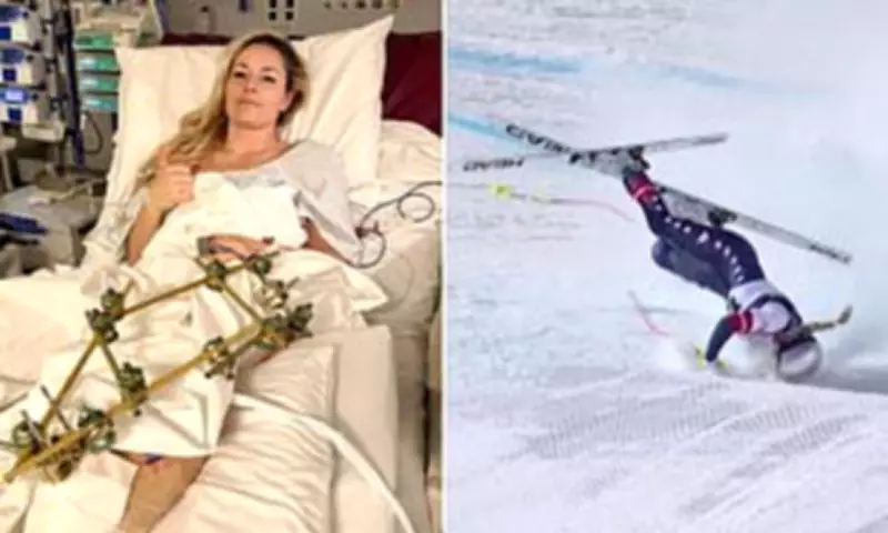 Lindsey Vonn Prepares to Return Home After Olympic Crash and Multiple Surgeries
