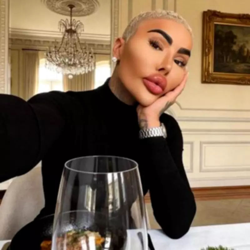 Lip King Manslaughter Probe Closed After Suspect's Death in BBL Case