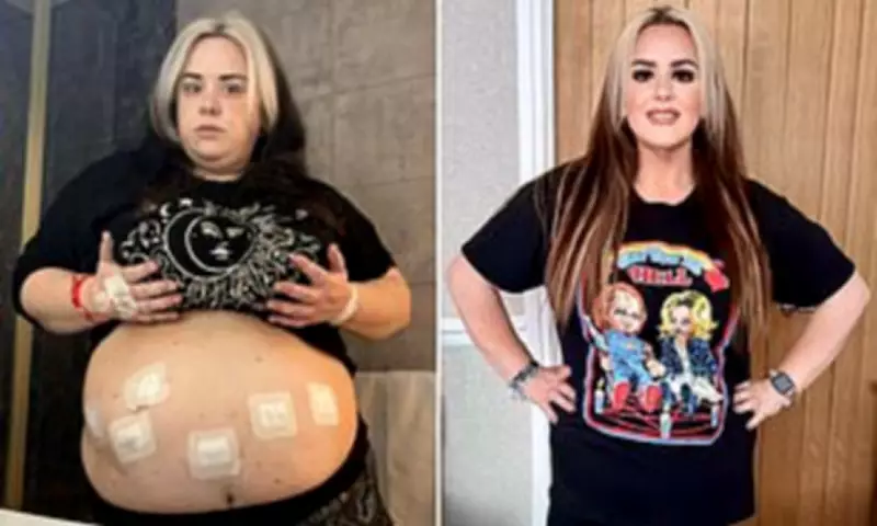 Liverpool Woman's 15 Stone Weight Loss After NHS Gastric Bypass Surgery