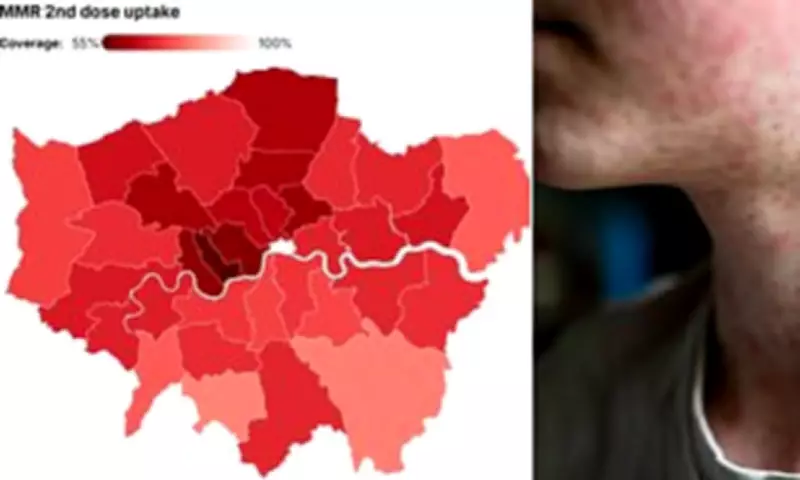 London Measles Outbreak: Health Officials Urge Parents to Vaccinate Children