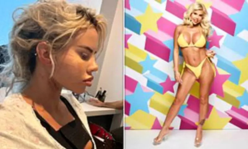 Love Island's Hannah Elizabeth Flaunts Facelift Results After £100k Surgery Spree