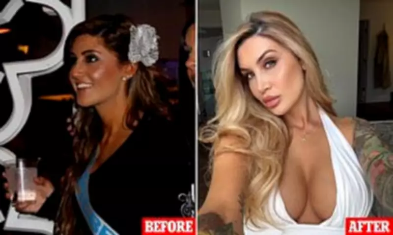 MAFS Star Gia Fleur Reveals $40k Surgery Journey After Teen Bullying