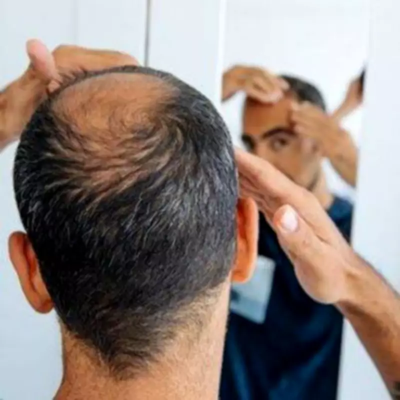 Man's Shaved Head Transformation Makes Him Look Eight Years Younger