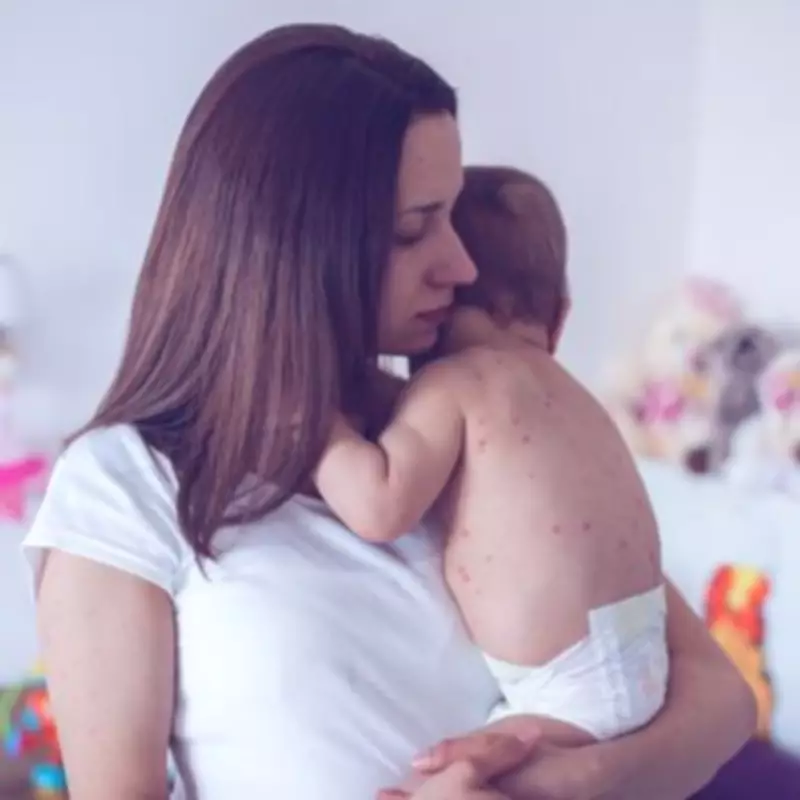 Measles Cases Surge 21% in One Week, School Outbreak Revealed