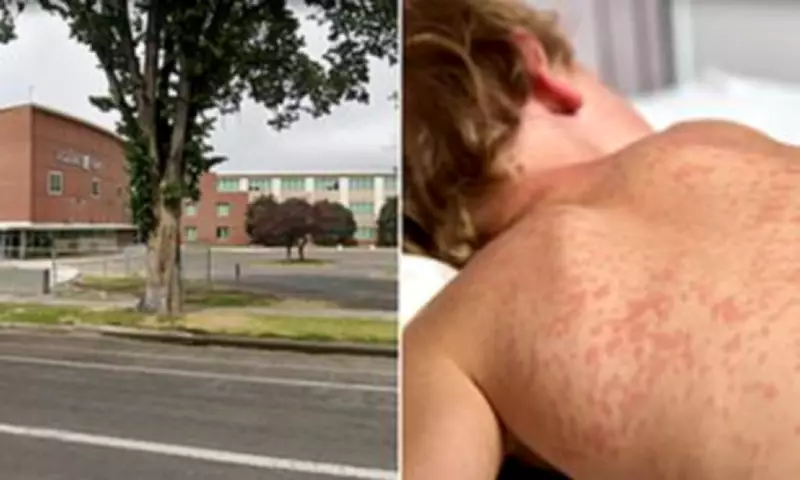 Measles Outbreak Alert: Utah High School Exposes 2,000 Students to Virus