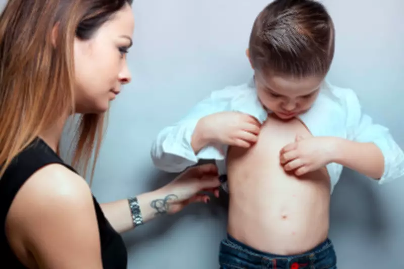 Measles Outbreak Spreads Across UK, Infecting Dozens of Children