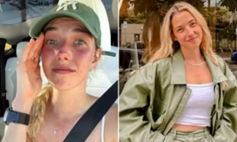 Melbourne Creator Recounts Park Rape Threat After Run, Sparks Safety Debate