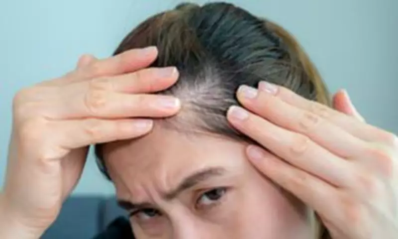 Menopause Hair Loss Affects Over Half of Women, New Research Reveals