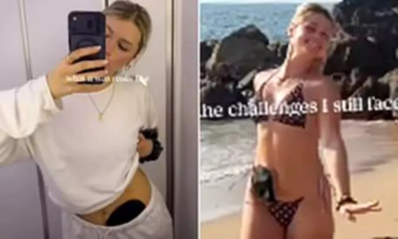 Mollie Pearce Opens Up About Stoma Bag Travel Struggles in Thailand