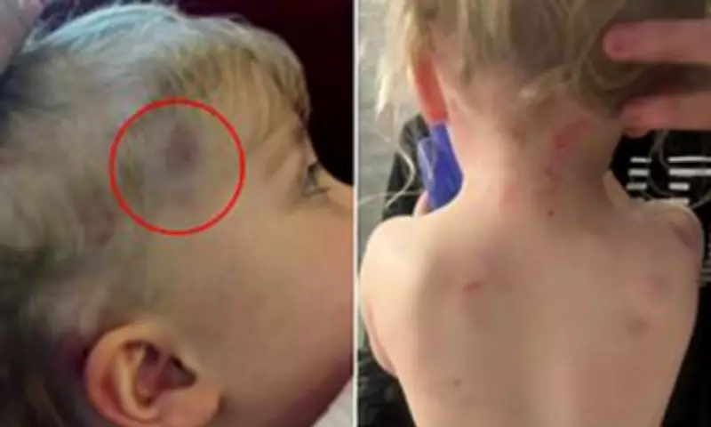 Mother Demands Answers After Toddler Hit with Shovel at Daycare