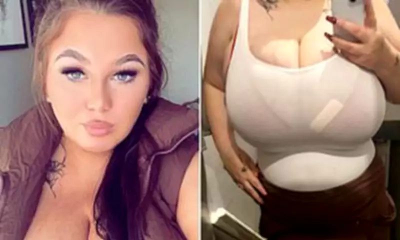 Mother Denied NHS Breast Reduction Despite Sepsis Risk from Bust Size