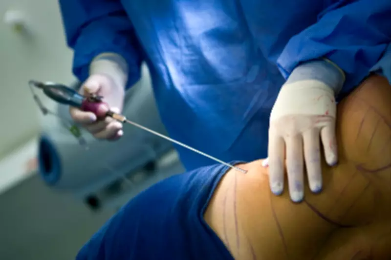 MPs Demand Immediate Ban on Liquid Brazilian Butt Lifts Over Safety Fears