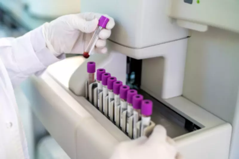 New Blood Test Offers Hope for Earlier Pancreatic Cancer Detection
