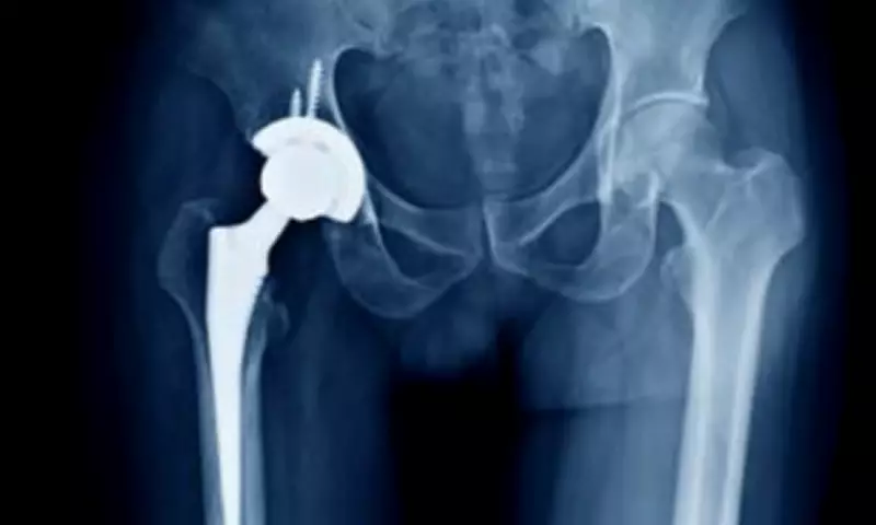 NHS Joint Replacement Surgeries Face Cancellations Amid Bone Cement Shortage