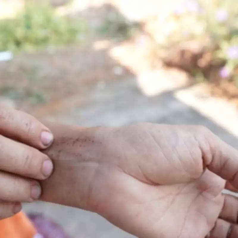 NHS Warns Itchy Skin With Toilet Symptoms Could Signal Pancreatic Cancer