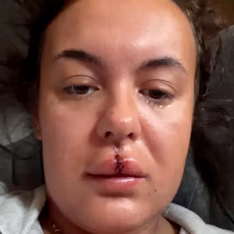 NHS Worker's Perfect Smile Destroyed in Freak Fall, Faces £8,000 Dental Bill